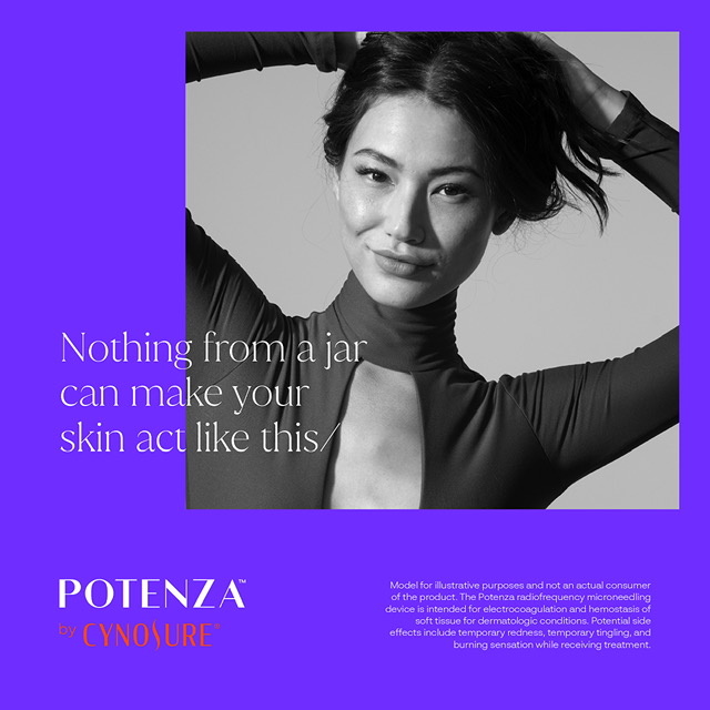 Potenza RF Microneedling